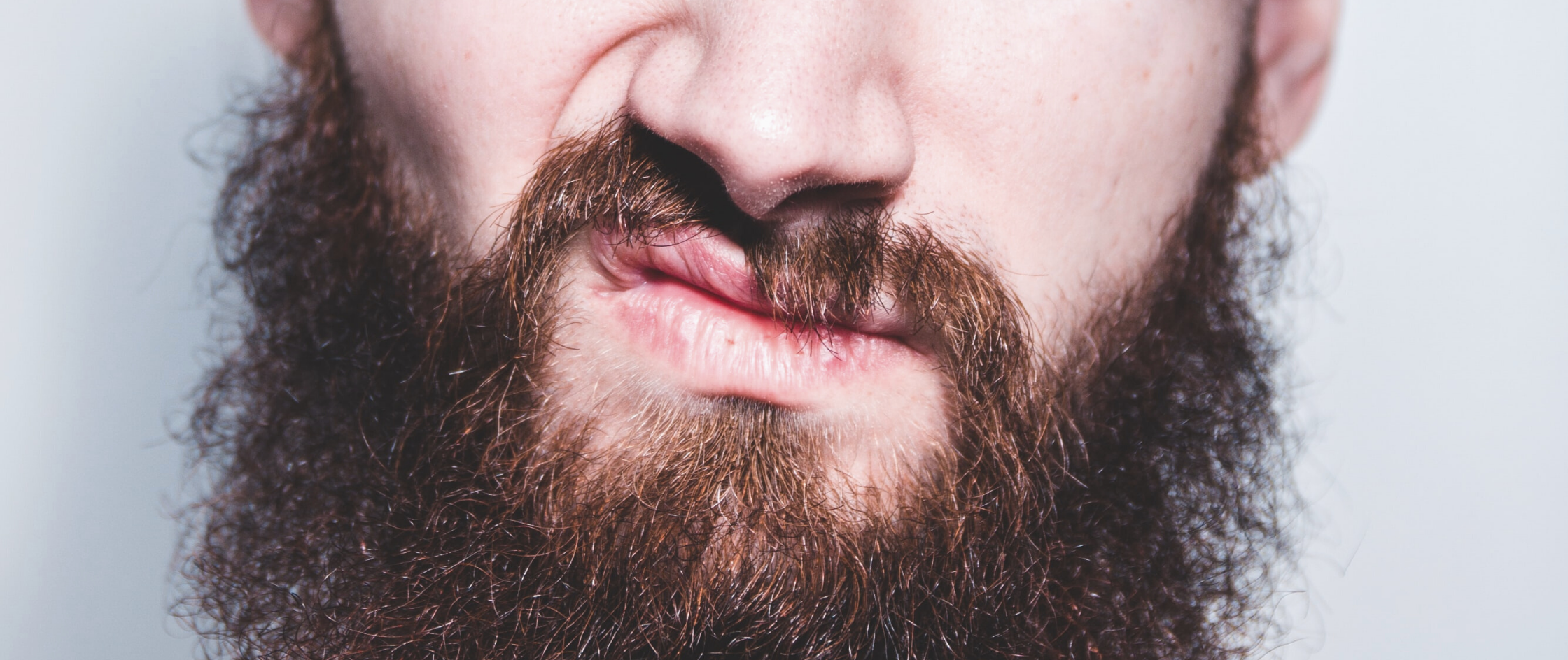 Beard Itch