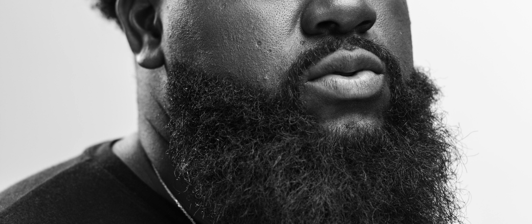 Beard Dandruff (Beardruff): How to Get Rid of It